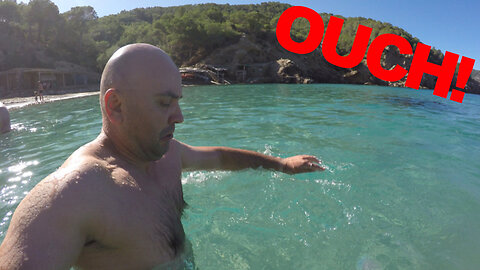 I got stung by a very poisonous jellyfish in Ibiza!