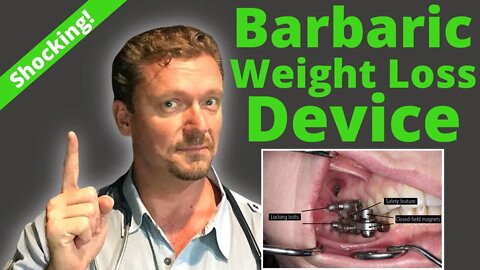 Barbaric New WEIGHT LOSS Device! (Weight Loss Research Insanity?) 2021