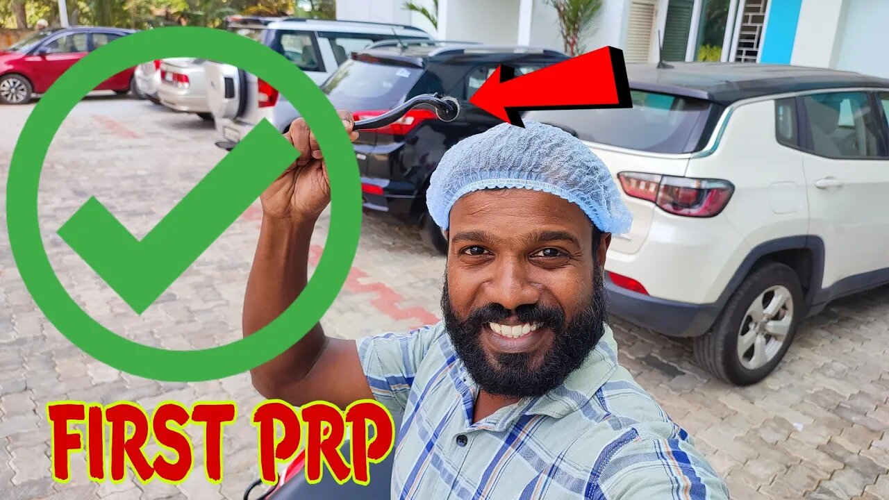 FIRST PRP IS DONE. MINOXIDIL MINTOP 10 RESULT. THIS IS HOW THE PRP TREATMENT FOR HAIR IS DONE