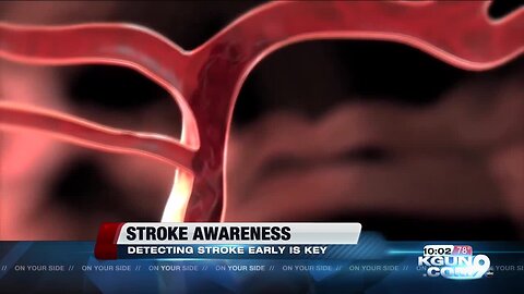 Stroke awareness: key getting to the hospital on time