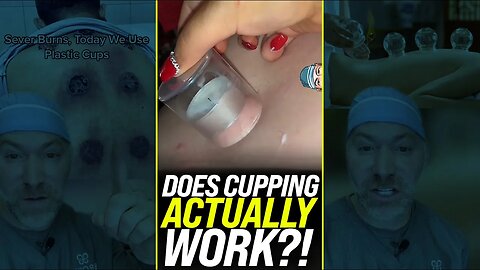 Does Cupping Actually Work?! 😱 #shorts