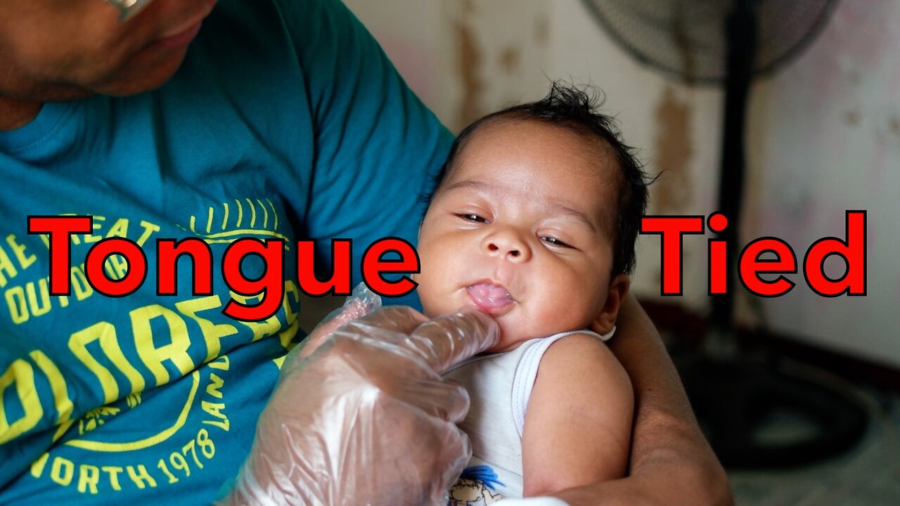 Tongue Tie (Ankyloglossia) pt1