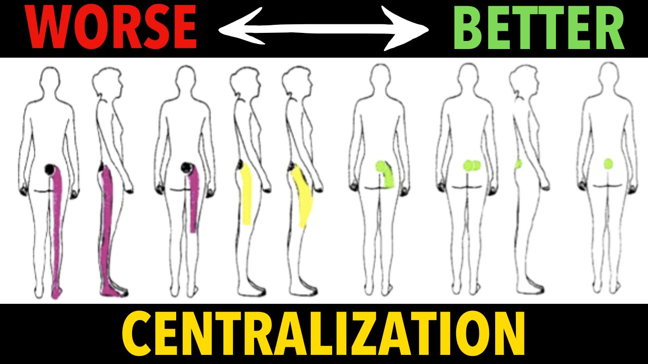 Directionally Specific Exercises For Low Back Pain