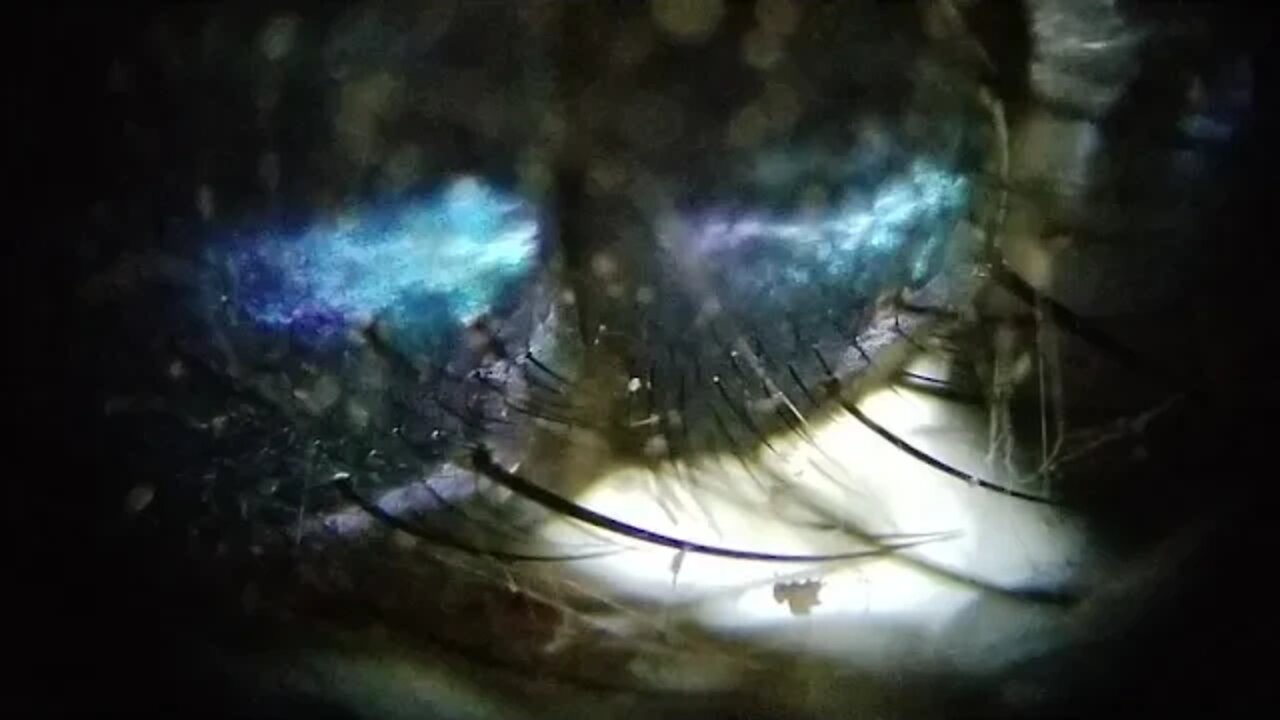 Invasion of the Body Snatchers & Nano Drones - Fly Magnification 40x