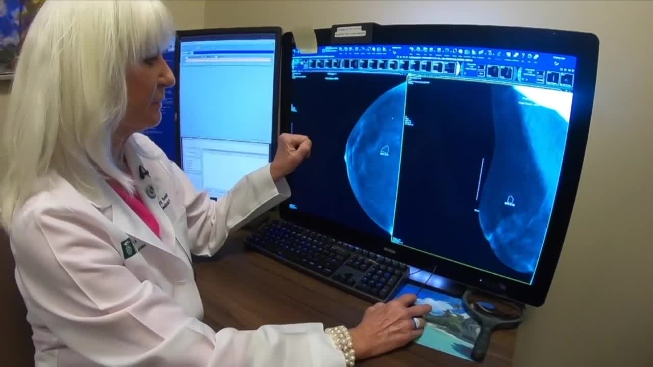 New technology at Boca Raton Regional Hospital helps find breast cancer earlier