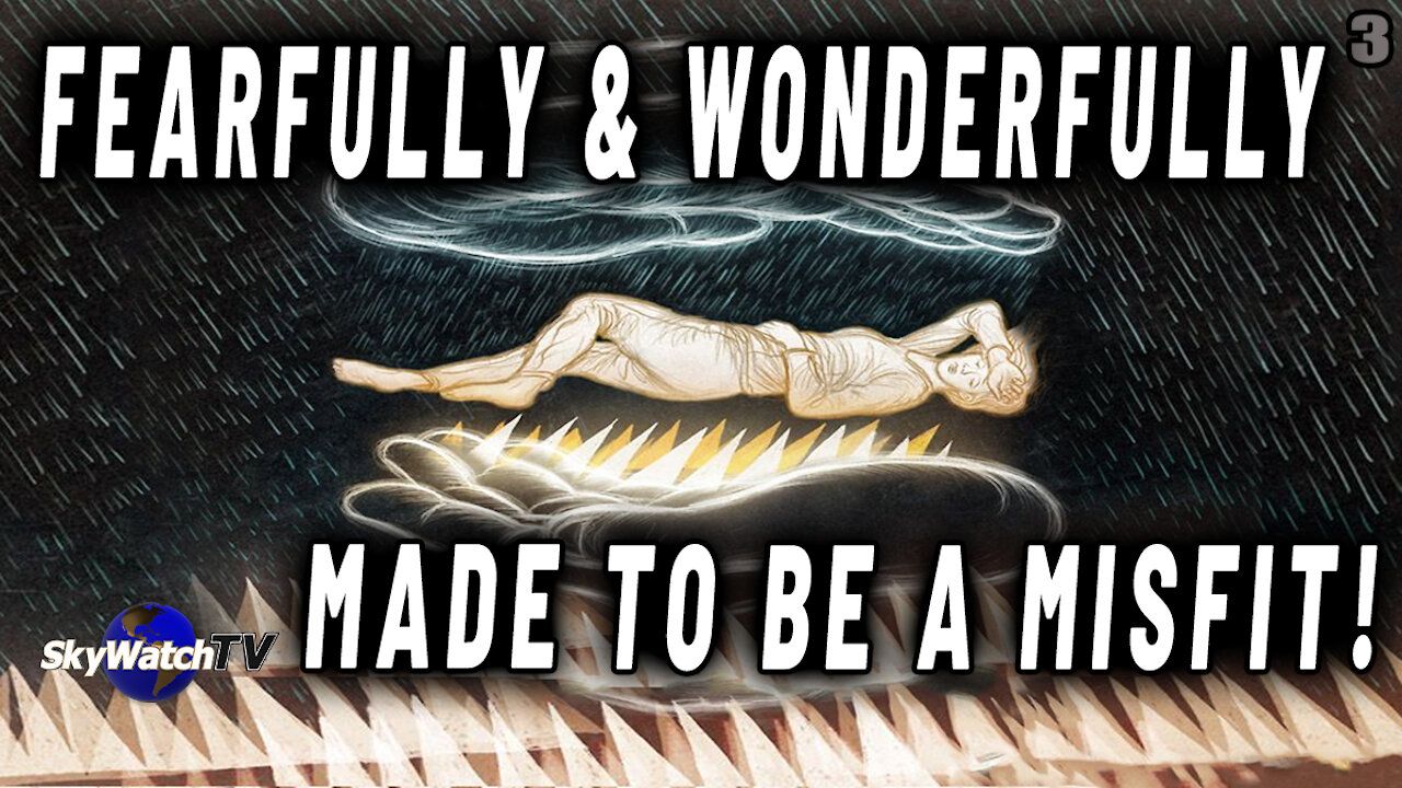 THE MYSTERIOUS REASONS GOD FEARFULLY & WONDERFULLY MAKES SOME PEOPLE "MISFITS"