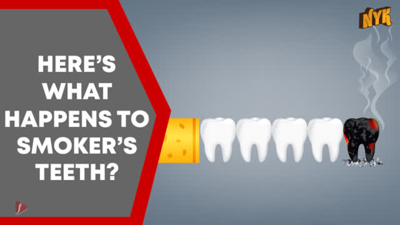 How Smoking Affects Your Oral Health?