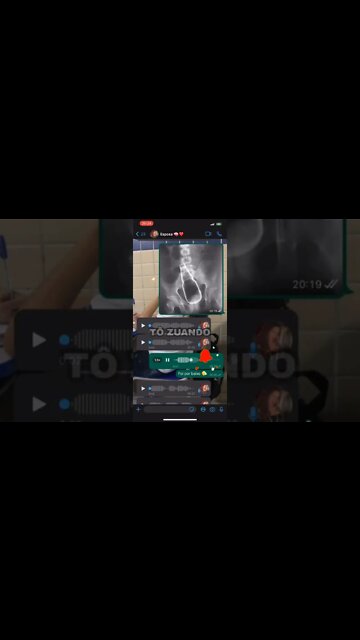 ACONTECE 🤷🏻‍♂️🤣