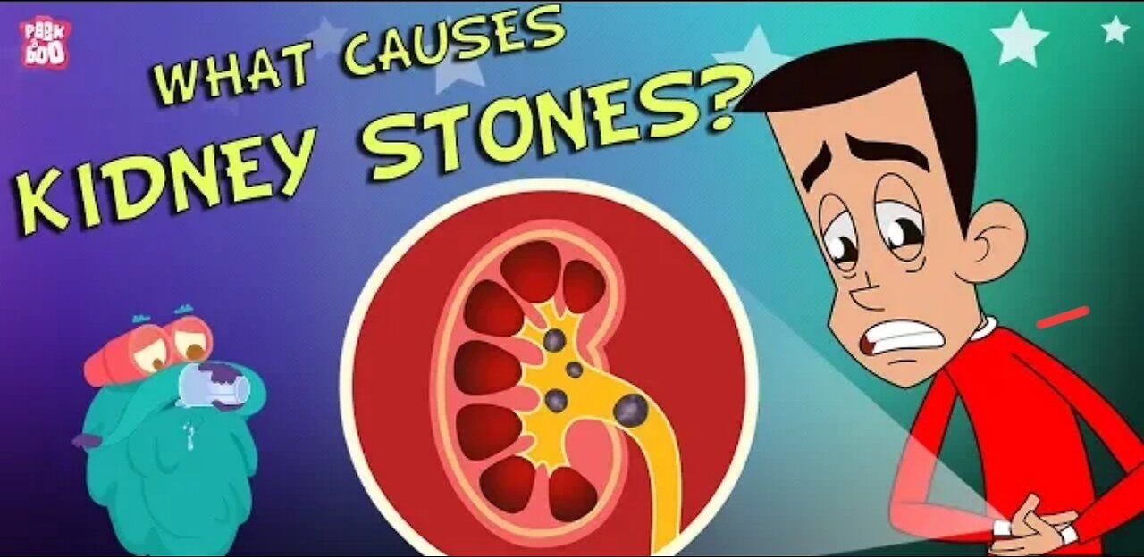 What Causes Kidney Stones? | Best learning video.