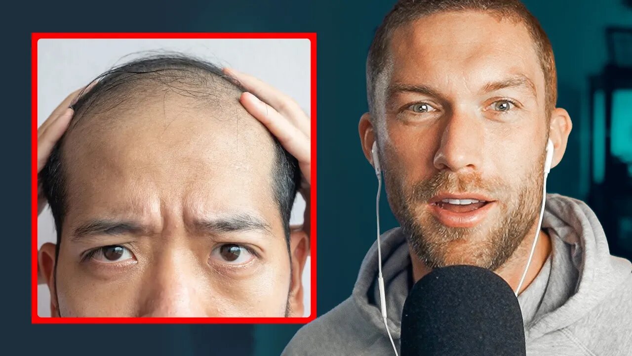 Calling A Man Bald Can Now Be Classed As Sexual Harassment