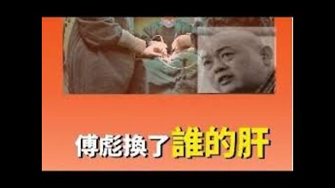 傅彪8个月内居然两次换肝 牺牲他人两条命?