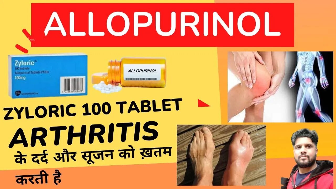 ZYLORIC 100 | ALLOPURINOL | ARTHRITIS PAIN | दर्द और सूजन से राहत | USE | SIDEE FFECTS हिंदी में