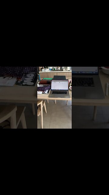 My Trading Losses Revealed 😱#trading