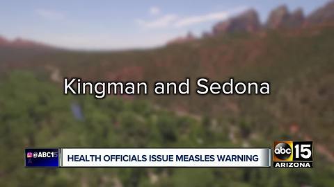 Health officials warn of potential measles exposure in northern Arizona