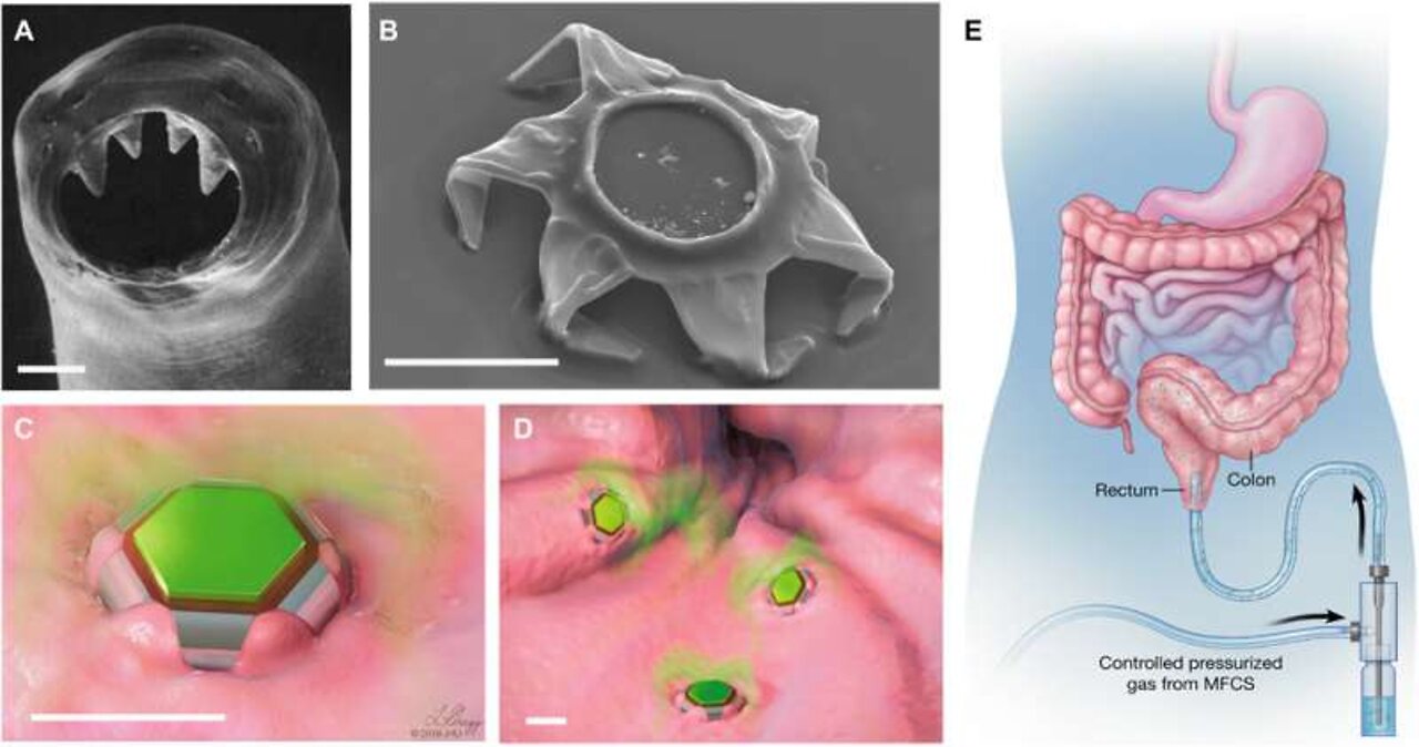 Vaxxine Nano Particles