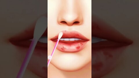 lip care #shorts #youtubeshorts #ytshort