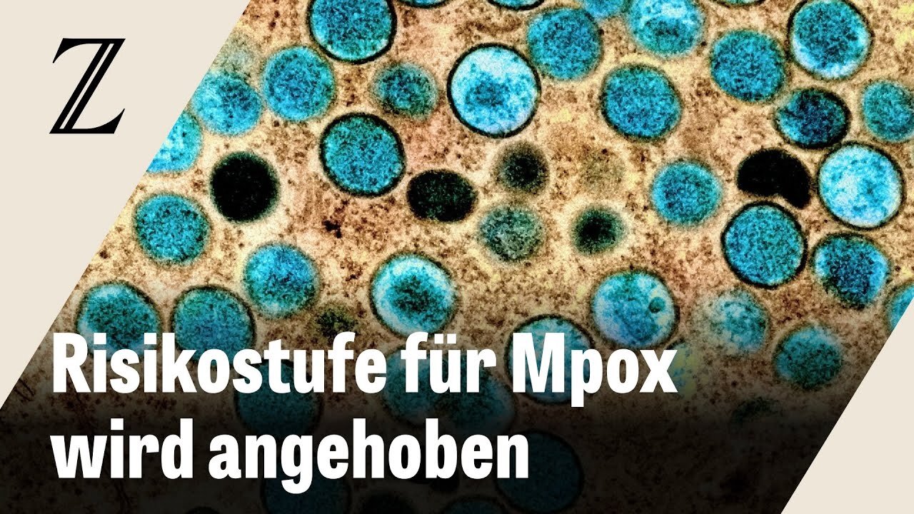 Europäische Gesundheitsbehörde erhöht Risikobewertung für Mpox