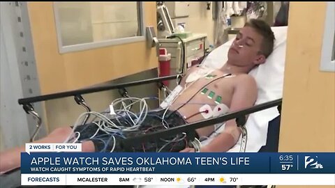 Apple watch saves Oklahoma teen's life