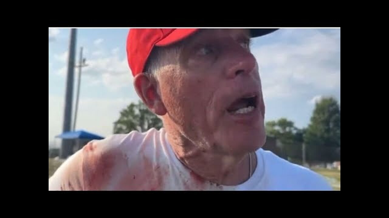 BLOODIED WITNESS SPEAKS. Donald Trump SHOT. Pennsylvania