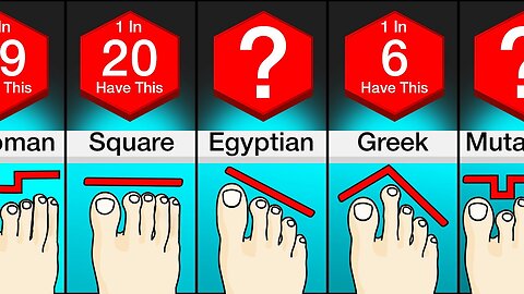 Comparison: Different Types Of Feet