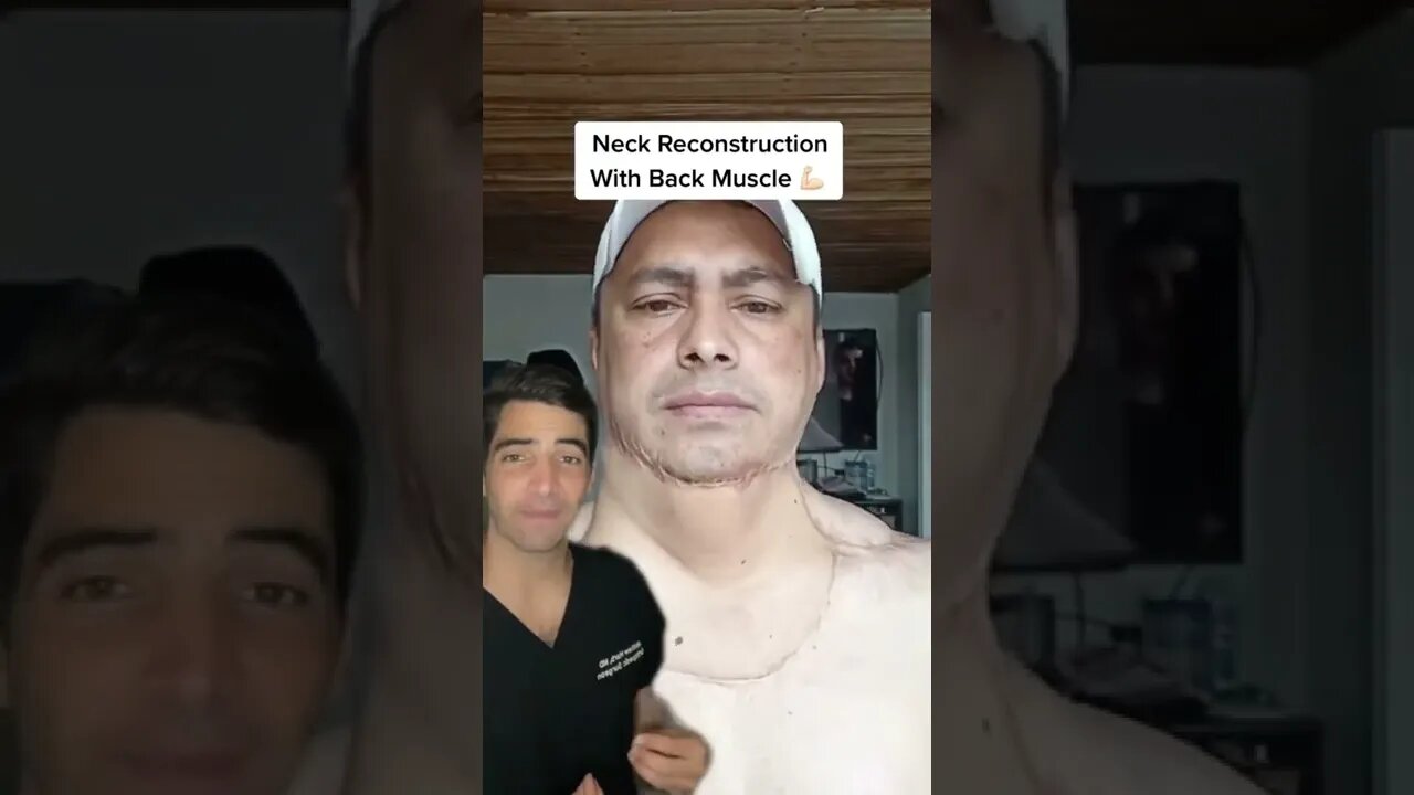 Muscle Flap