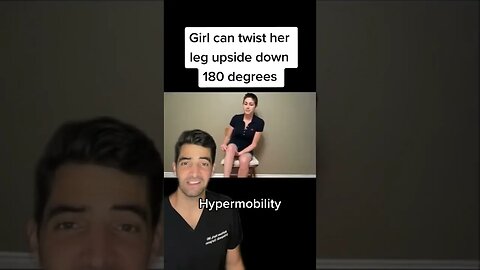 Hypermobility, crazy leg twist
