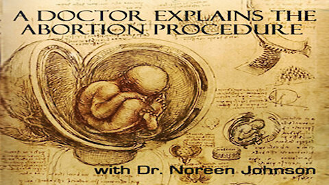 A Doctor Explains The Abortion Procedure || With Dr. Noreen Johnson