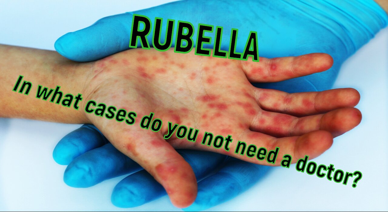 Childhood rubella - when do you not need a doctor?