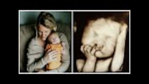 Parents Refuse To Have Abortion, 3 Months Later Mom Discovers Something That Brings Her To Tears