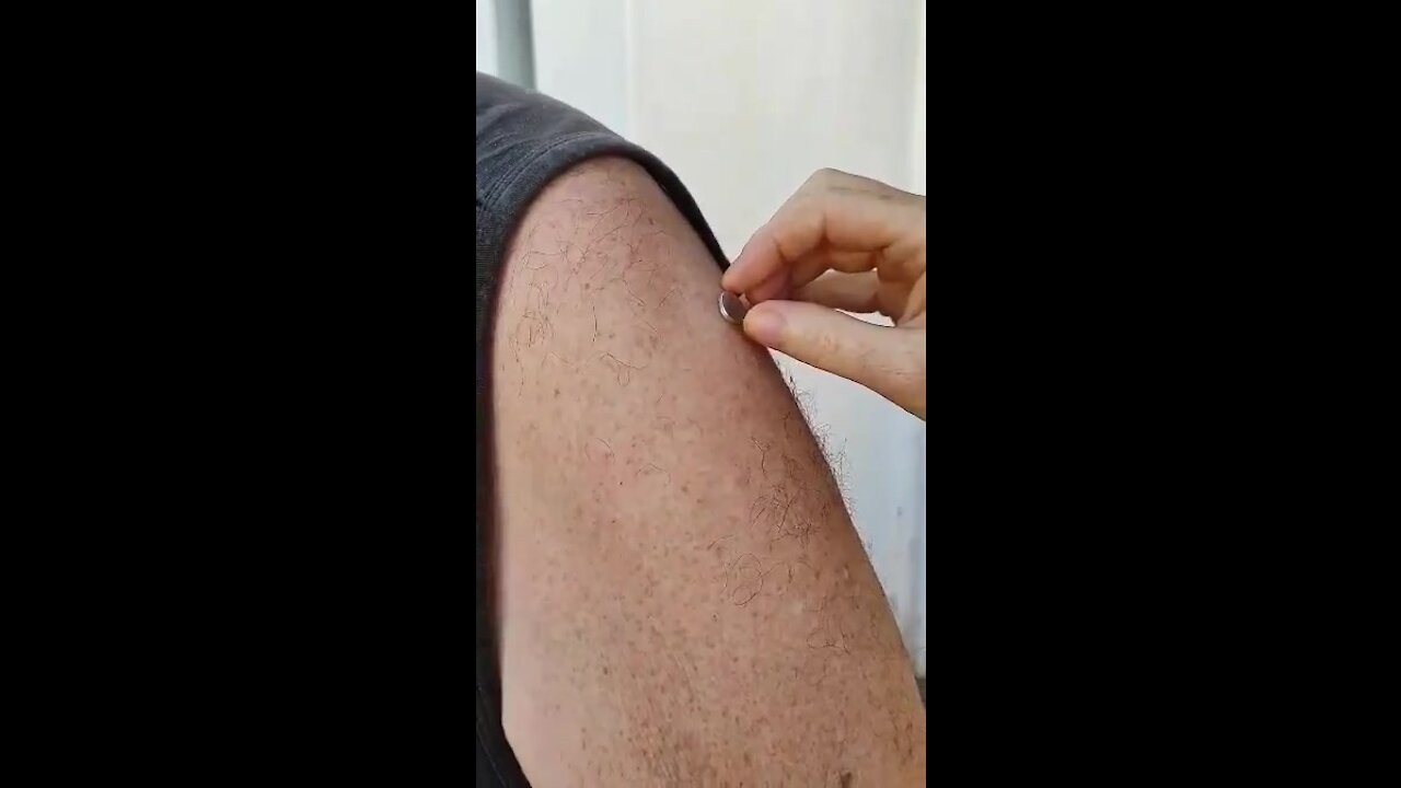 Magnetic Arm after Jab