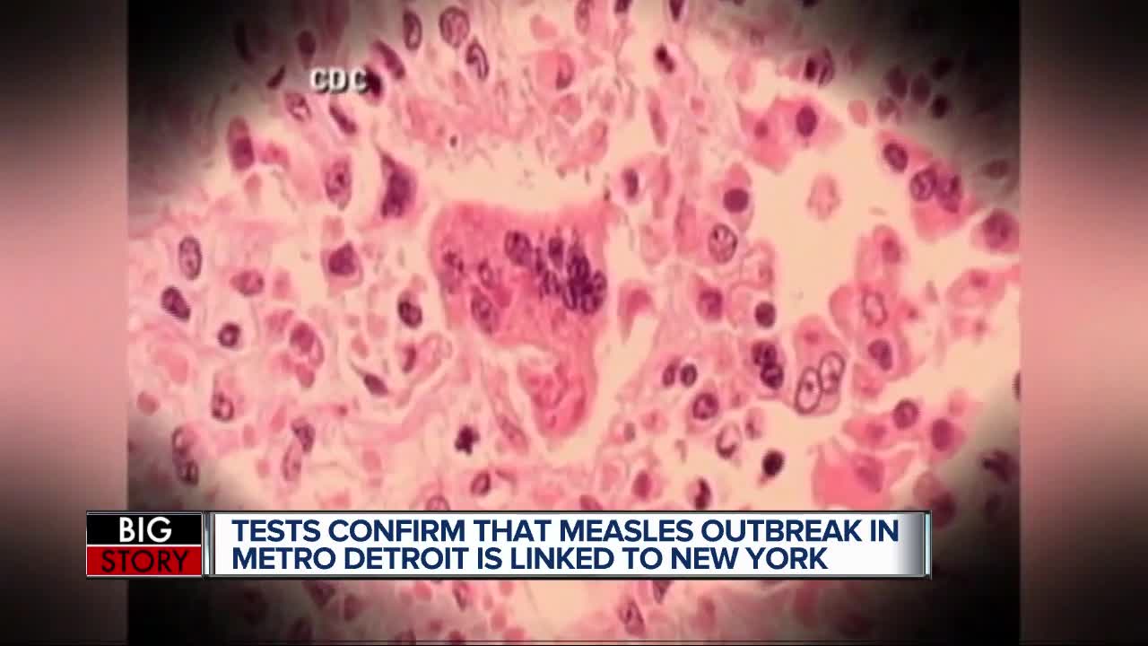 Michigan measles outbreak linked to ongoing outbreak in New York