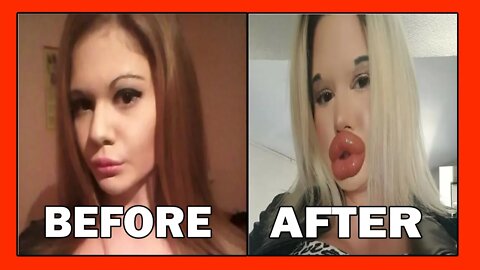 Addiction to Bratz Lips Look could Kill