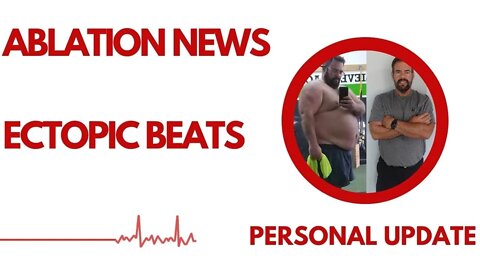 Personal Update - Ablation referral, Holter monitor results now in on my ectopic beats fix