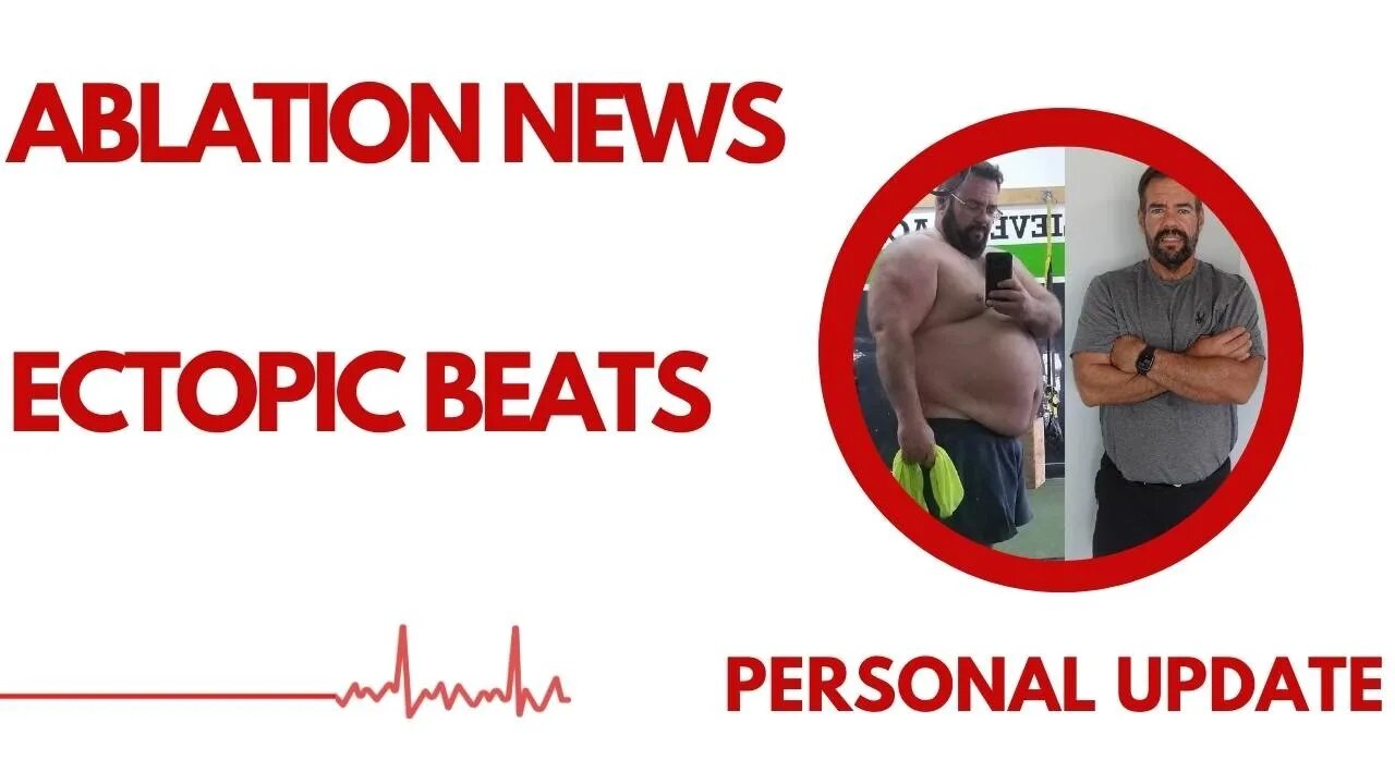 Personal Update - Ablation referral, Holter monitor results now in on my ectopic beats fix
