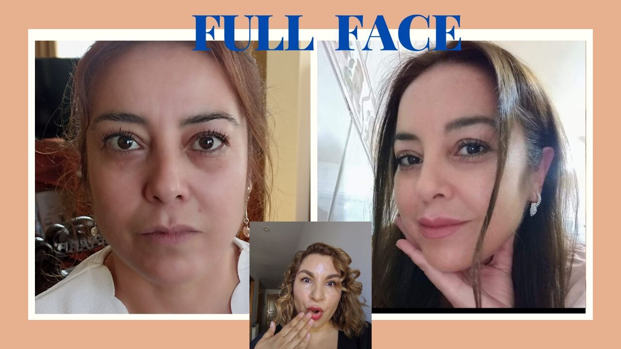 TRATAMIENTO FULL FACE