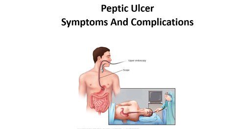 Peptic Ulcers - Diagnosis, Treatment & Complications