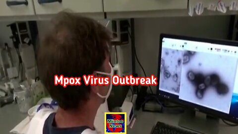 Sweden confirms first case of new mpox variant