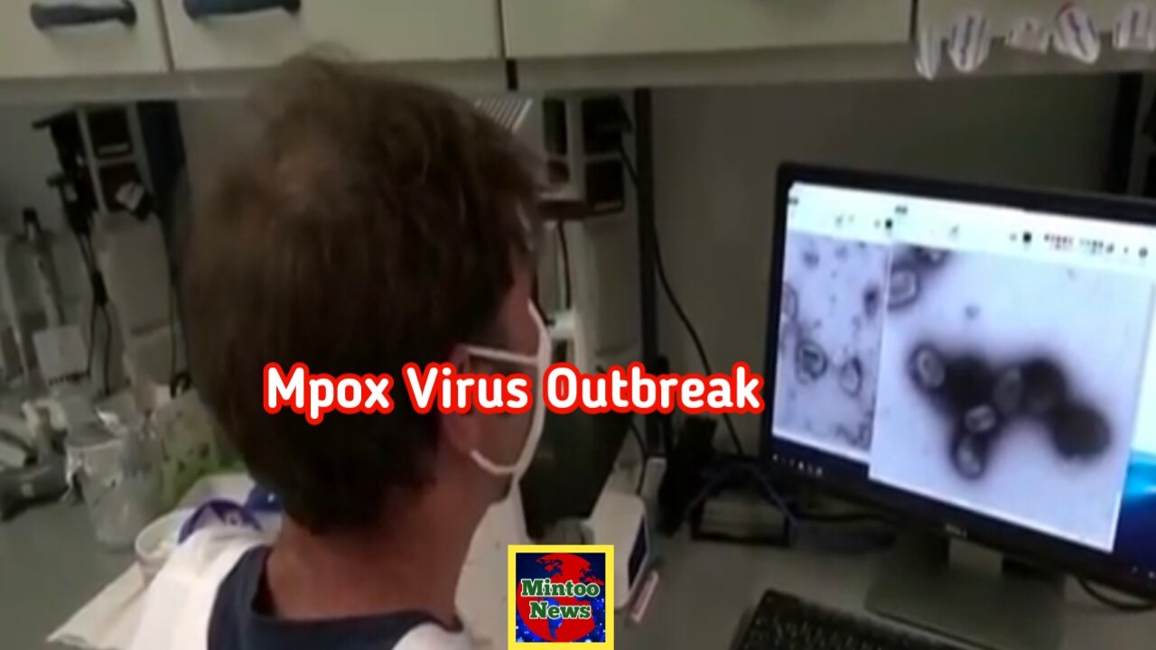 Sweden confirms first case of new mpox variant
