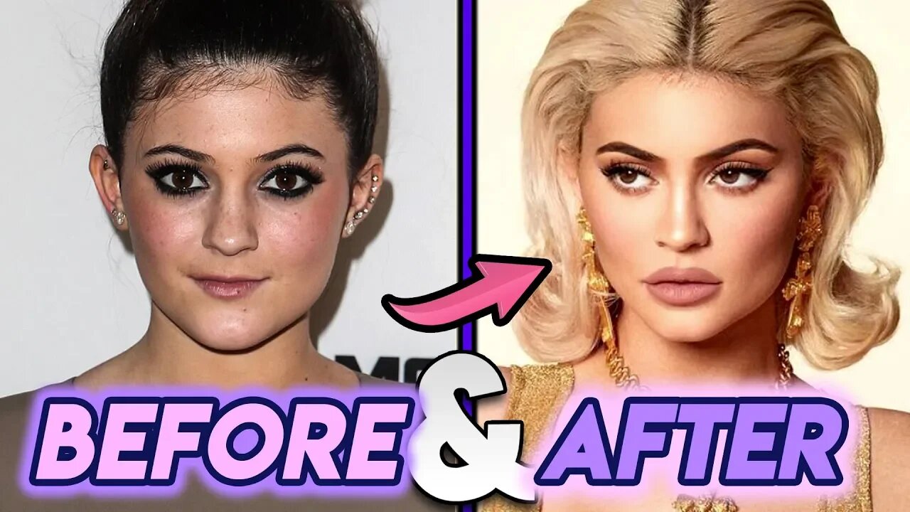 Kylie Jenner | Before & After Transformations | Plastic Surgery UPDATED