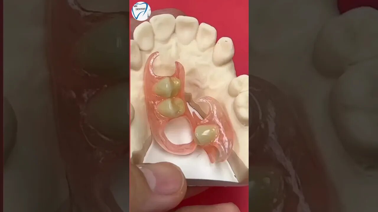 Two unilateral flexi partials Dental