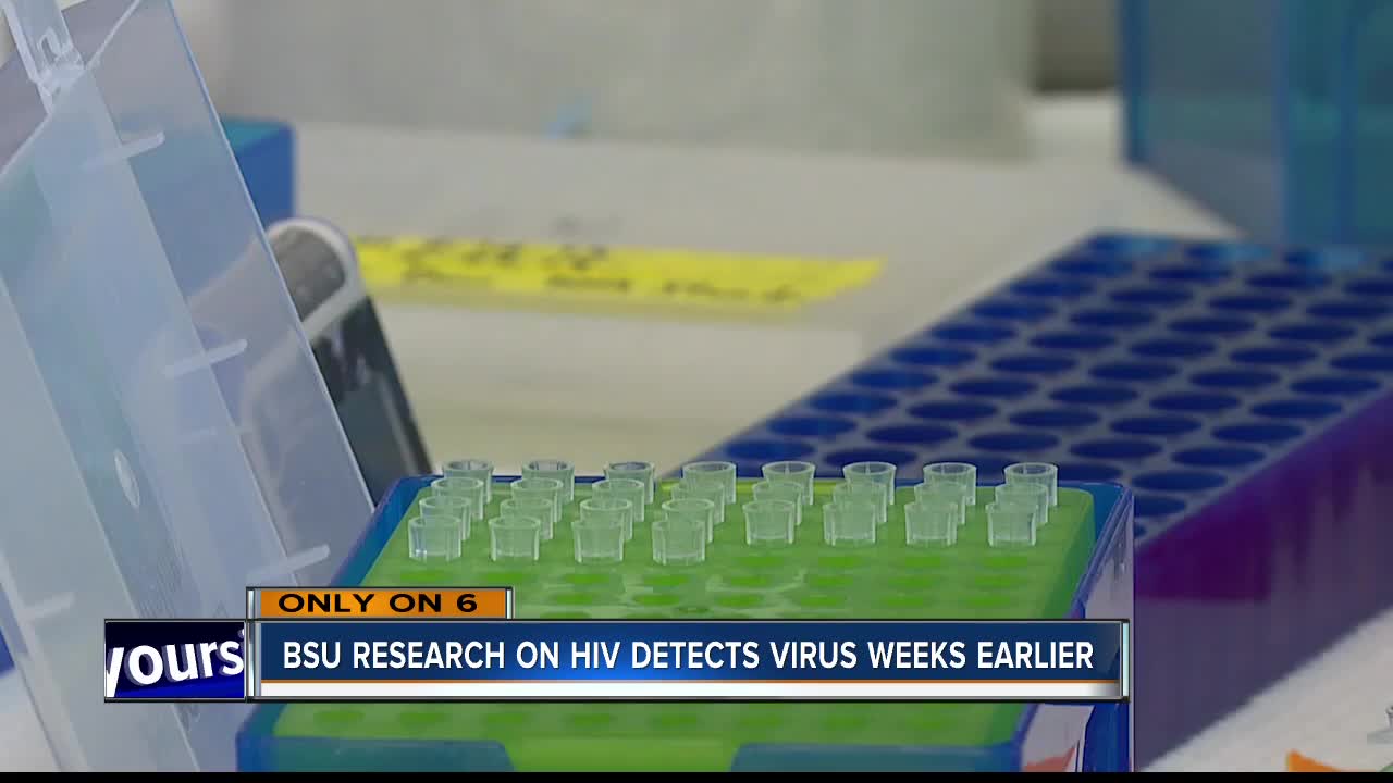 New research at Boise State could detect HIV weeks earlier than standard tests