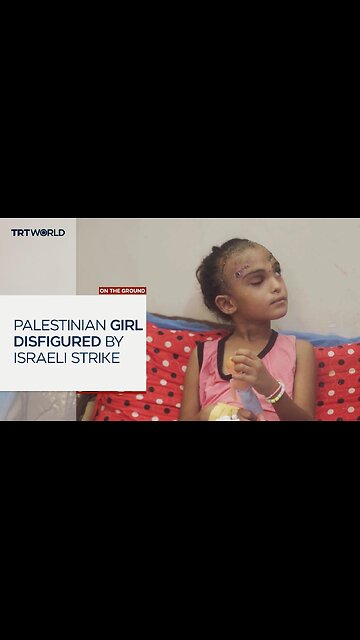 Seven-year-old Palestinian girl disfigured in Israeli attack