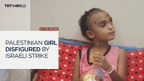 Seven-year-old Palestinian girl disfigured in Israeli attack