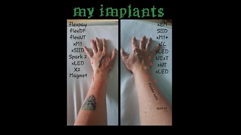 The Stage Is Set For The Mark Of The Beast | BE WARNED!!