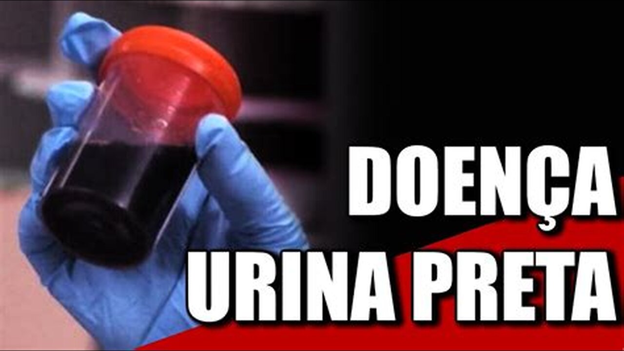 URINA PRETA = REAÇÃO A PICADA C19💉