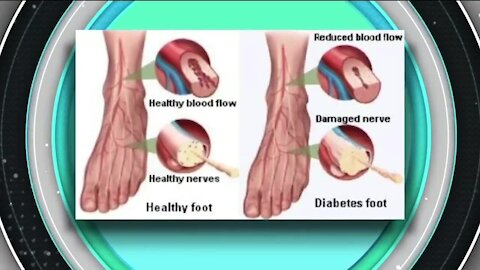 Understand Neuropathy // Front Range Medical Center