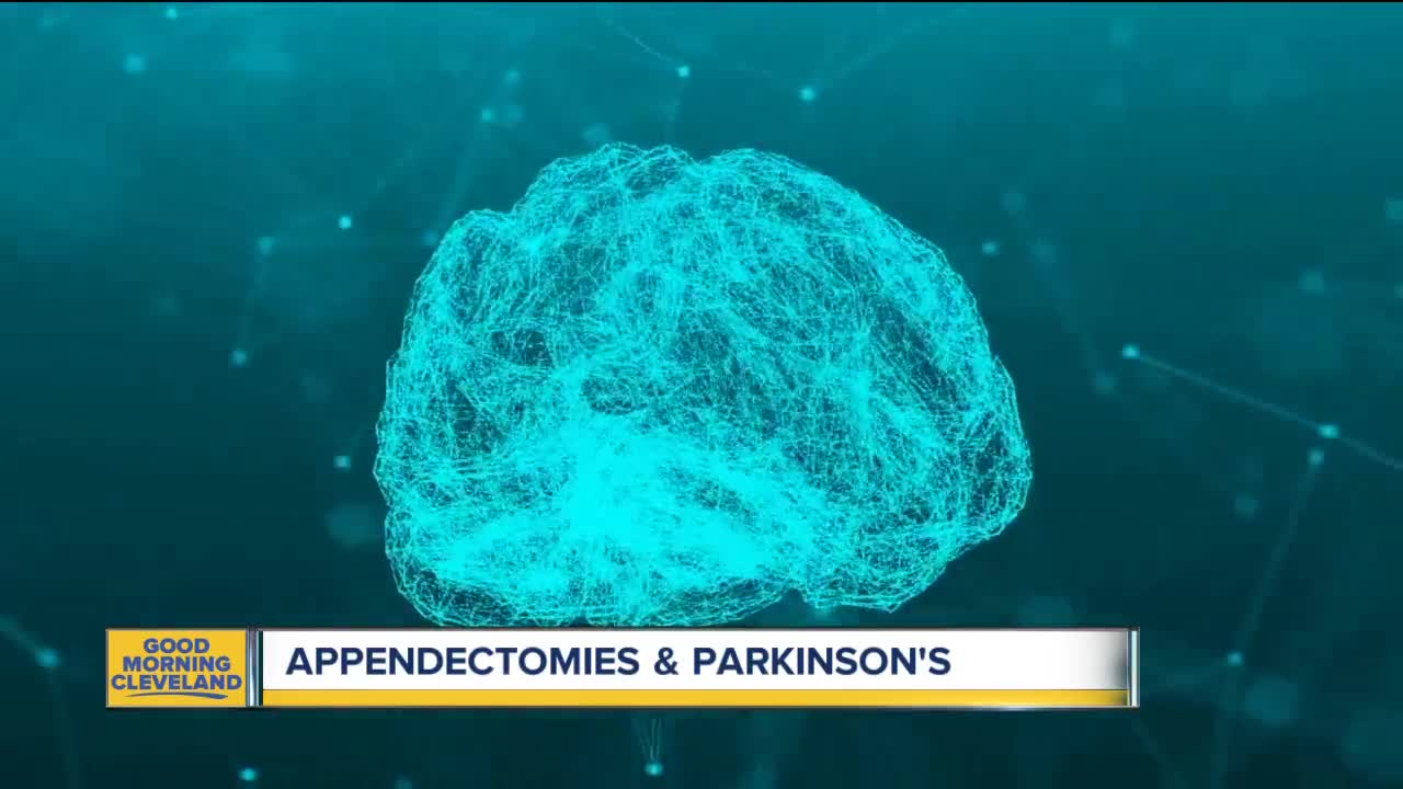 Appendix removal connected to Parkinson's disease, study shows