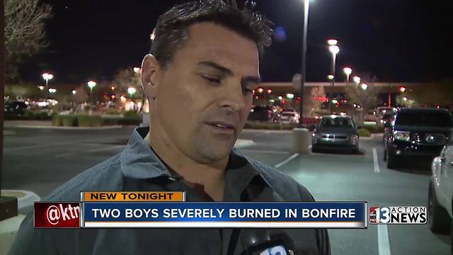 Two boys severely burned in bonfire