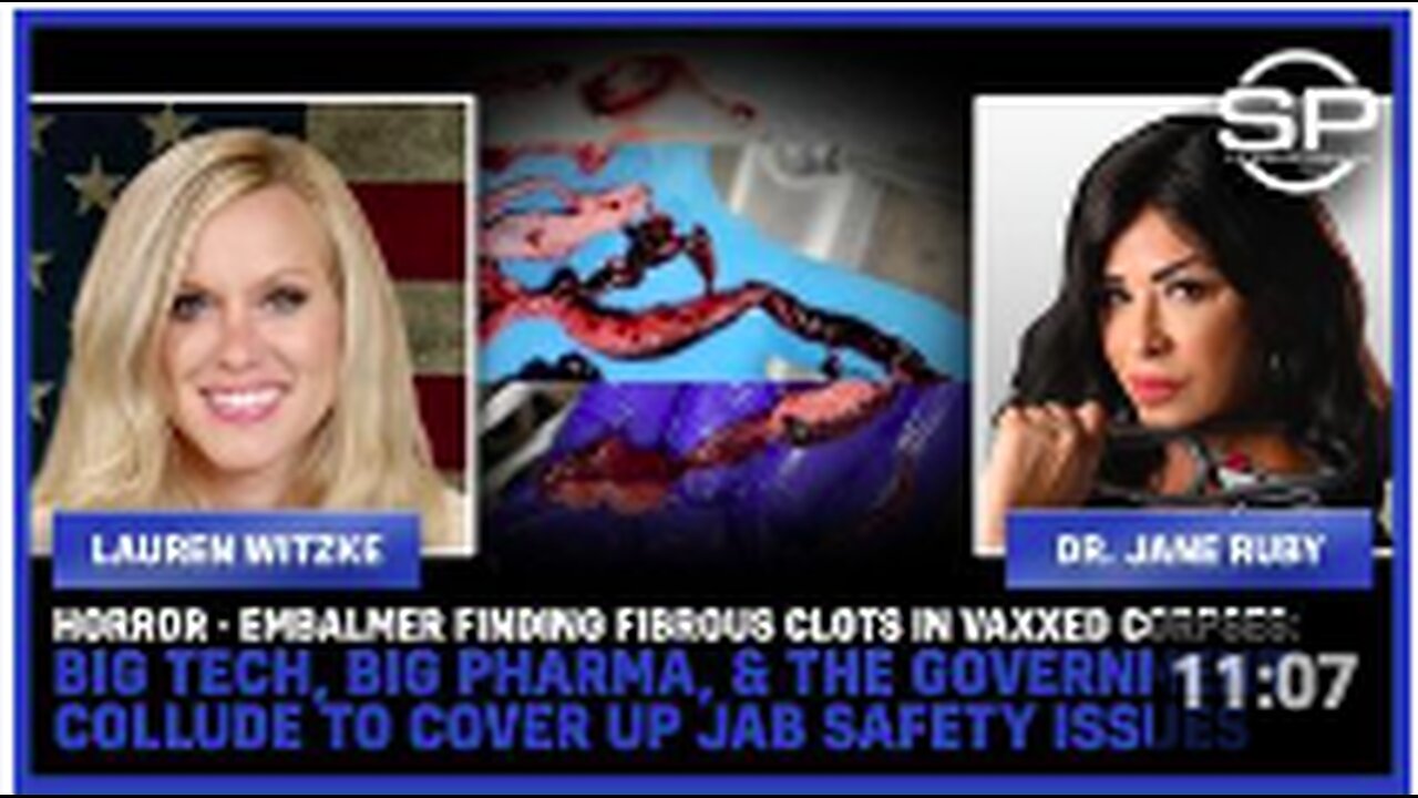 HORROR: Embalmer Finding Fibrous Clots In Vaxxed Corpses;