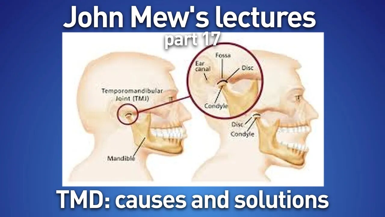 John Mew's lectures part 17: TMD causes and solutions